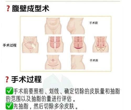 林博杰医生口碑怎么样？医生价格表标准更新