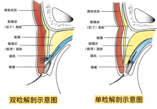 双眼皮9.jpg 双眼皮9.jpg