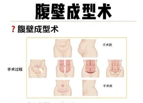 形体塑造.jpg 形体塑造.jpg