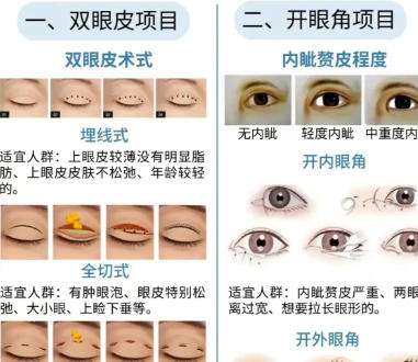 双眼皮 双眼皮