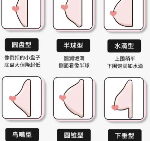 隆胸 隆胸