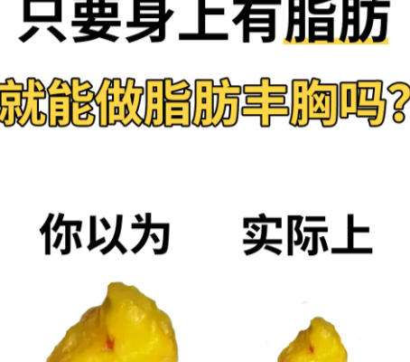 隆胸dm17.jpg