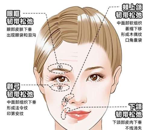 面部提升 面部提升