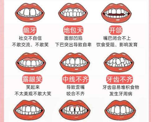 牙颌发育畸形矫正1.jpg 牙颌发育畸形矫正1.jpg