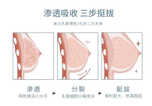 玻尿酸丰胸.jpg
