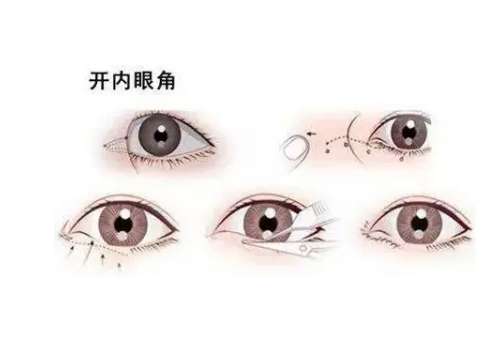 开眼角2.jpg