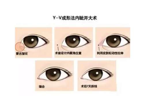 开眼角3.jpg