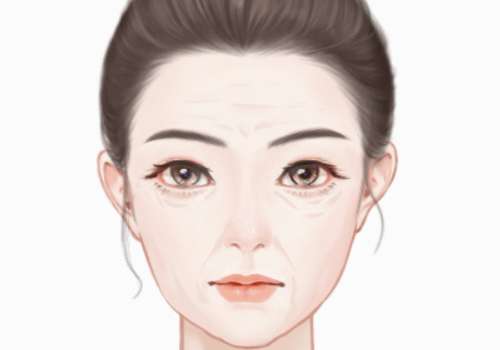 拉皮.jpg