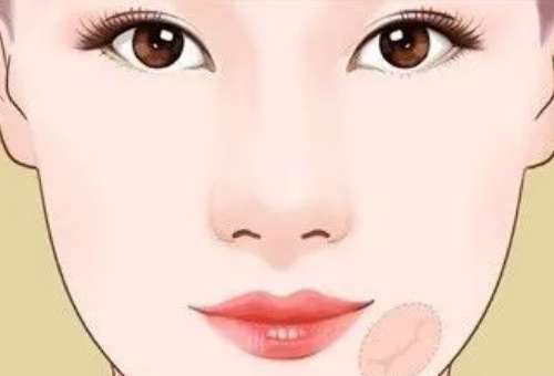 疤痕2.jpg