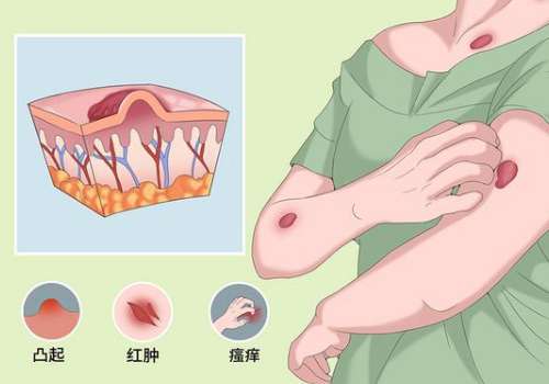 疤痕11.jpg