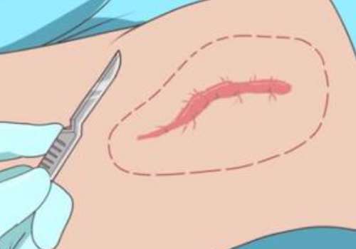 疤痕1.jpg