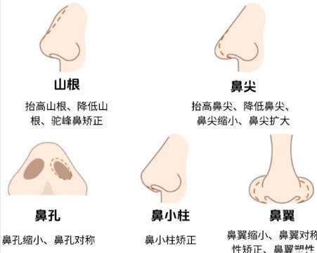 隆鼻16.jpg
